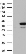 HEK293T cells were transfected with the pCMV6-ENTRY control (Left lane) or pCMV6-ENTRY RMND5A (Right lane) cDNA for 48 hrs and lysed. Equivalent amounts of cell lysates (5 ug per lane) were separated by SDS-PAGE and immunoblotted with anti-RMND5A.