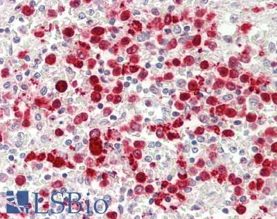 Human Spleen: Formalin-Fixed, Paraffin-Embedded (FFPE)