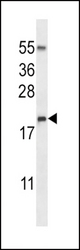 RNASE3 Antibody western blot of NCI-H460 cell line lysates (35 ug/lane). The RNASE3 antibody detected the RNASE3 protein (arrow).