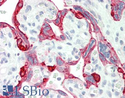 Human Placenta: Formalin-Fixed, Paraffin-Embedded (FFPE)