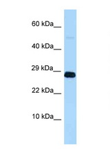 Western blot of Rat Lung lysate. Anti-RNF11 Antibody concentration 1 ug/ml.