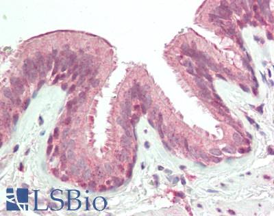 Human Lung: Formalin-Fixed, Paraffin-Embedded (FFPE)