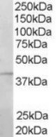 Antibody staining (1 ug/ml) of Human Bone Marrow lysate (RIPA buffer, 35 ug total protein per lane). Primary incubated for 1 hour. Detected by Western blot of chemiluminescence.