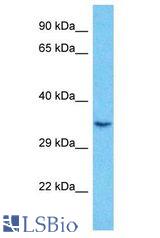 RING1B / BAP1 / RNF2 antibody Western Blot of MDA-MB-435s. Antibody dilution: 1 ug/ml.