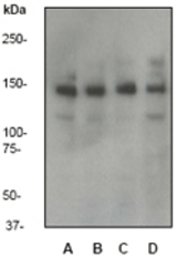 Western blot of anti-ASIP antibody, dilution 1:500. A: LNCap B: HeLa C: A431 D: MCF-7