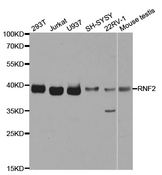 Western blot analysis of extracts of various cell lines, using RNF2 antibody.