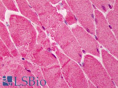 Anti-RNF2 antibody IHC of human skeletal muscle. Immunohistochemistry of formalin-fixed, paraffin-embedded tissue after heat-induced antigen retrieval. Antibody LS-B417 concentration 2.5 ug/ml.