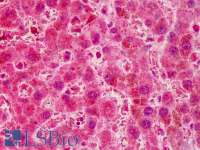 Anti-RNF2 antibody IHC of human liver. Immunohistochemistry of formalin-fixed, paraffin-embedded tissue after heat-induced antigen retrieval. Antibody LS-B417 concentration 2.5 ug/ml.