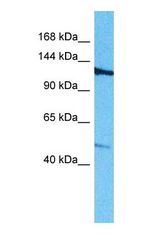 Western blot of ROBO3 Antibody with human Jurkat Whole Cell lysate.