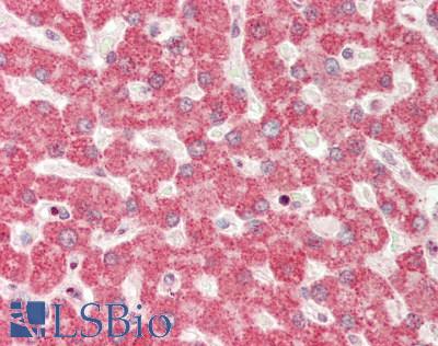Human Liver: Formalin-Fixed, Paraffin-Embedded (FFPE)