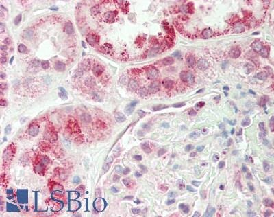 Human Kidney: Formalin-Fixed, Paraffin-Embedded (FFPE)
