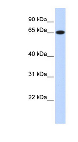 RPN1 antibody western blot of Transfected 293T cell lysate.