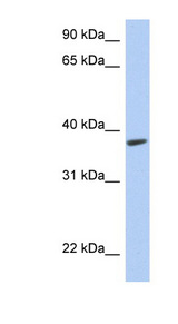 RTDR1 antibody LS-C111596 Western blot of Fetal Muscle lysate.