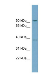 RTDR1 antibody LS-C111595 Western blot of COLO205 cell lysate.
