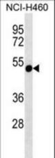 RTDR1 Antibody western blot of NCI-H460 cell line lysates (35 ug/lane). The RTDR1 antibody detected the RTDR1 protein (arrow).