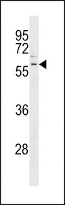 The anti-Parkin antibody is used in Western blot to detect Parkin in mouse kidney tissue lysate.