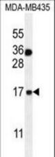 S100A1 Antibody western blot of MDA-MB435 cell line lysates (35 ug/lane). The S100A1 antibody detected the S100A1 protein (arrow).