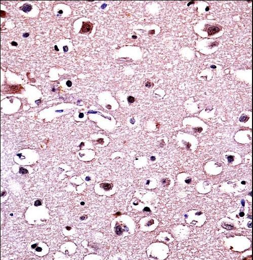 Parkin Antibody immunohistochemistry of formalin-fixed and paraffin-embedded human brain tissue followed by peroxidase-conjugated secondary antibody and DAB staining.