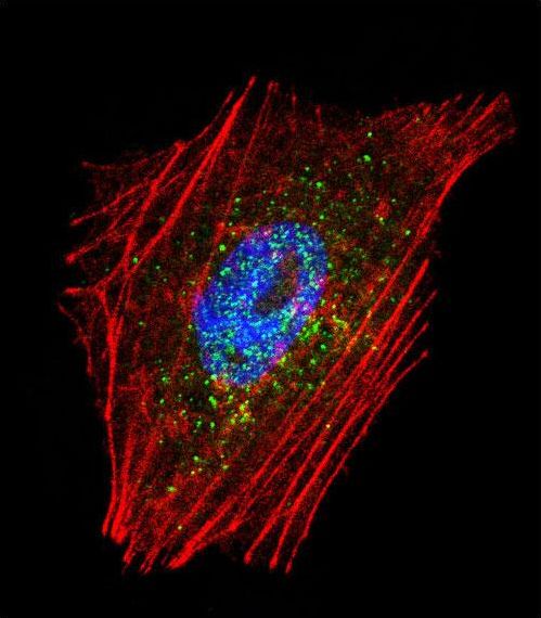 Confocal immunofluorescent of Parkin Antibody with NCI-H460 cell followed by Alexa Fluor 488-conjugated goat anti-rabbit lgG (green). Actin filaments have been labeled with Alexa Fluor 555 phalloidin (red). DAPI was used to stain the cell nuclear (blue).