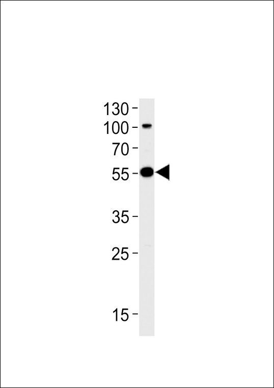 Western blot of lysate from SH-SY5Y cell line, using Park2 Antibody. Antibody was diluted at 1:1000 at each lane. A goat anti-rabbit (HRP) at 1:5000 dilution was used as the secondary antibody. Lysate at 35ug.