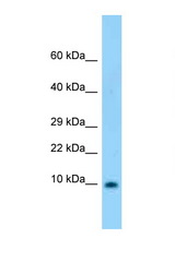 S100B antibody LS-C146395 Western blot of Rat Brain lysate. Antibody concentration 1 ug/ml.