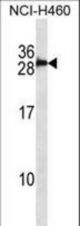 S100B/S-100 Antibody western blot of NCI-H460 cell line lysates (35 ug/lane). The S100B/S-100 antibody detected the S100B/S-100 protein (arrow).