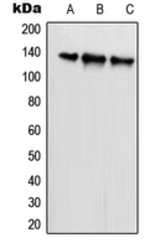 Western blot analysis of SCAF1 expression in HeLa (A); U2OS (B); NIH3T3 (C) whole cell lysates.