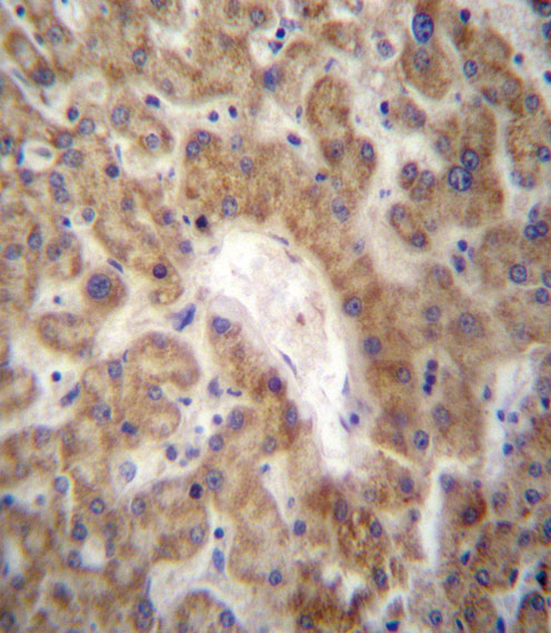 CXCL12 Antibody immunohistochemistry of formalin-fixed and paraffin-embedded human liver tissue followed by peroxidase-conjugated secondary antibody and DAB staining.