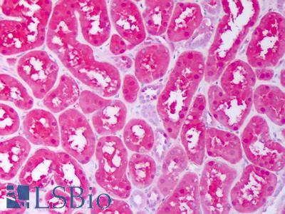 Anti-CXCL12 antibody IHC of human kidney, tubules. Immunohistochemistry of formalin-fixed, paraffin-embedded tissue after heat-induced antigen retrieval. Antibody LS-B7489 concentration 2.5 ug/ml.