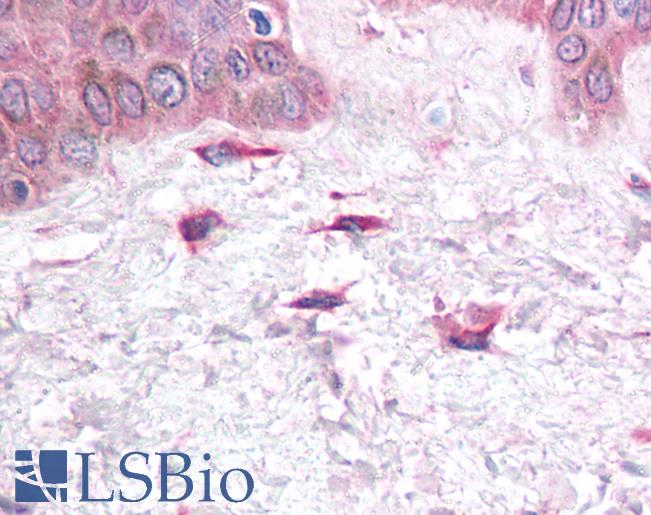 Anti-CXCL12 antibody IHC of human skin, fibroblasts. Immunohistochemistry of formalin-fixed, paraffin-embedded tissue after heat-induced antigen retrieval. Antibody LS-B943 concentration 5 ug/ml.