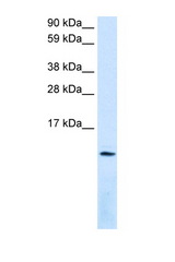 CXCL12 antibody LS-B943 Western blot of Fetal Lung lysate. Antibody concentration 1 ug/ml.