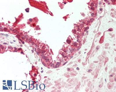 Human Prostate: Formalin-Fixed, Paraffin-Embedded (FFPE)