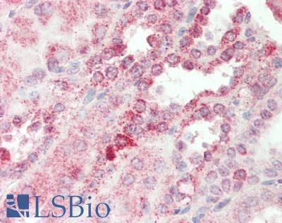 Human Kidney: Formalin-Fixed, Paraffin-Embedded (FFPE)
