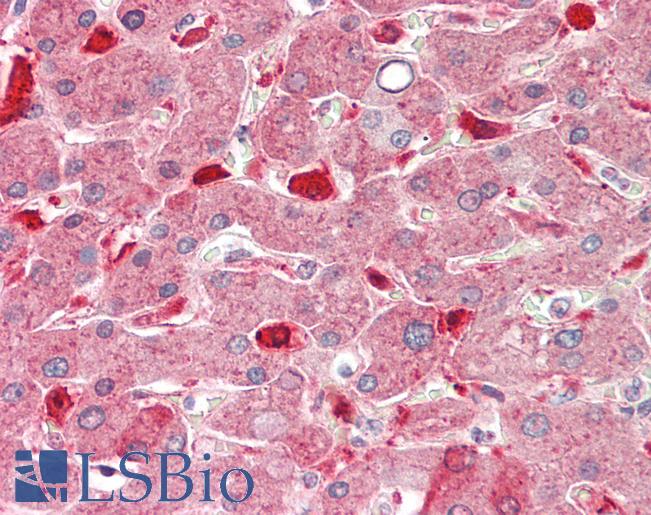 Human Liver: Formalin-Fixed, Paraffin-Embedded (FFPE)