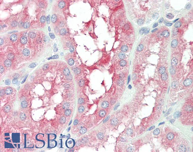 Human Kidney: Formalin-Fixed, Paraffin-Embedded (FFPE)