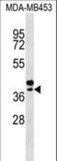 SEPP1 Antibody western blot of MDA-MB453 cell line lysates (35 ug/lane). The SEPP1 antibody detected the SEPP1 protein (arrow).