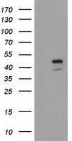 HEK293T cells were transfected with the pCMV6-ENTRY control (Left lane) or pCMV6-ENTRY SERPINB4 (Right lane) cDNA for 48 hrs and lysed. Equivalent amounts of cell lysates (5 ug per lane) were separated by SDS-PAGE and immunoblotted with anti-SERPINB4.