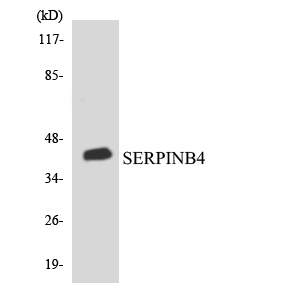 Western blot of the lysates from COLO205 cells using SERPINB4 antibody.