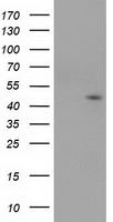 HEK293T cells were transfected with the pCMV6-ENTRY control (Left lane) or pCMV6-ENTRY SERPINB4 (Right lane) cDNA for 48 hrs and lysed. Equivalent amounts of cell lysates (5 ug per lane) were separated by SDS-PAGE and immunoblotted with anti-SERPINB4.