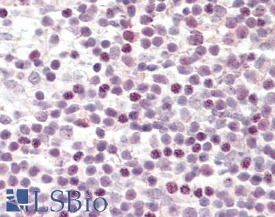 Human Tonsil: Formalin-Fixed, Paraffin-Embedded (FFPE)