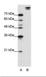 B: Jurkat Cell Lysate
