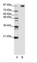 A: Marker, B: Jurkat Cell Lysate