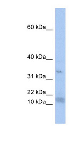 SF3B14 antibody LS-C110571 Western blot of THP-1 cell lysate.