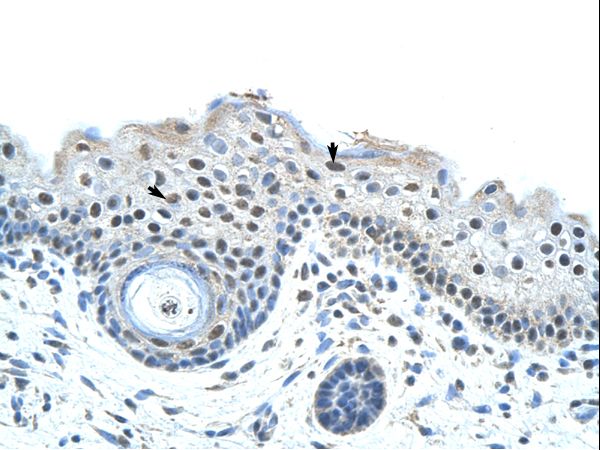 SF3B1 antibody LS-C31803 was used in IHC to stain formalin-fixed, paraffin-embedded human skin.