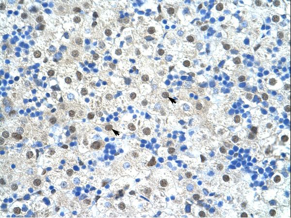 SF3B1 antibody LS-C31803 was used in IHC to stain formalin-fixed, paraffin-embedded human liver.