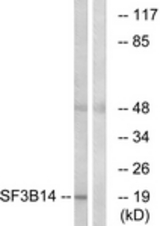 Western blot of extracts from HepG2 cells, using SF3B14 Antibody. The lane on the right is treated with the synthesized peptide.