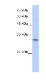 SFXN1 antibody LS-C102343 Western blot of Transfected 293T cell lysate.