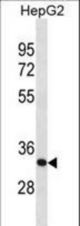 SFXN1 Antibody western blot of HepG2 cell line lysates (35 ug/lane). The SFXN1 antibody detected the SFXN1 protein (arrow).
