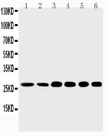 Sonic Hedgehog antibody Western blot. Lane 1: Rat Liver Tissue Lysate. Lane 2: Rat Intestine Tissue Lysate. Lane 3: HELA Cell Lysate. Lane 4: A549 Cell Lysate. Lane 5: SMMC Cell Lysate. Lane 6: MM231 Cell Lysate.