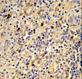 Formalin-fixed and paraffin-embedded human spleen tissue reacted with SIGLEC12 Antibody , which was peroxidase-conjugated to the secondary antibody, followed by DAB staining. This data demonstrates the use of this antibody for immunohistochemistry; clinical relevance has not been evaluated.